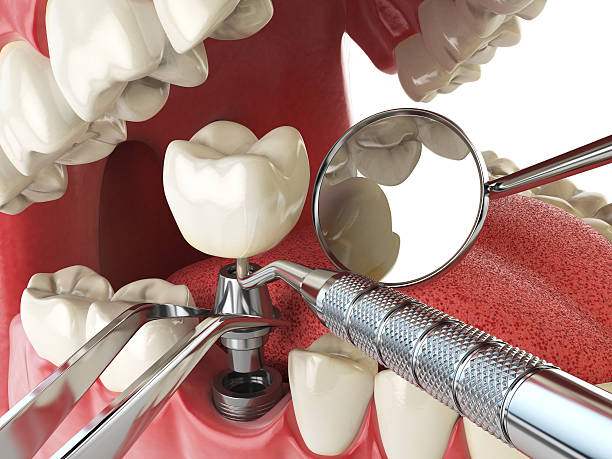 Best Emergency Dentist for Special Needs Patients in Lorton, VA